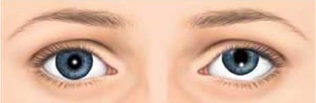 bansal-eye-hospital-squint-centre-left-vertical