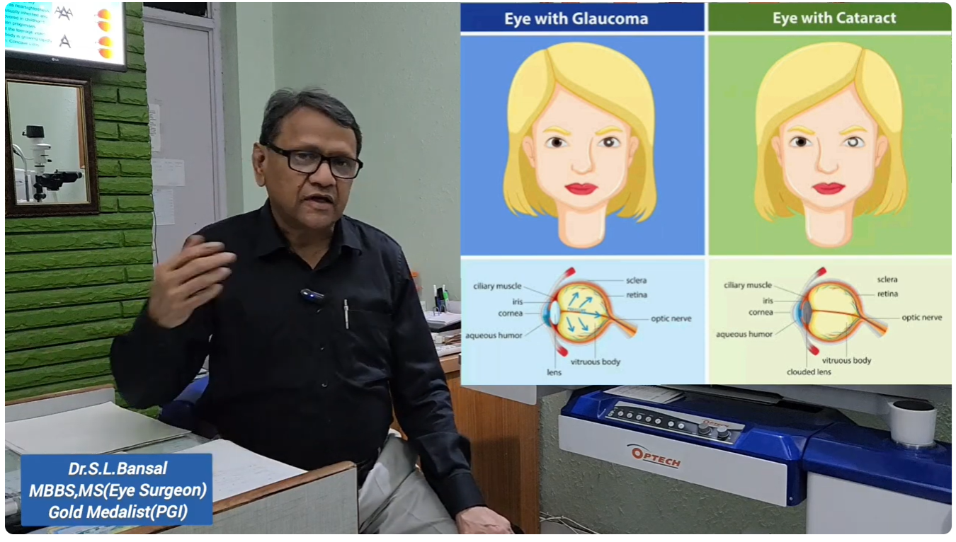 Kala Motiya (Glaucoma) - In My Own Words - Dr S-L-Bansal
